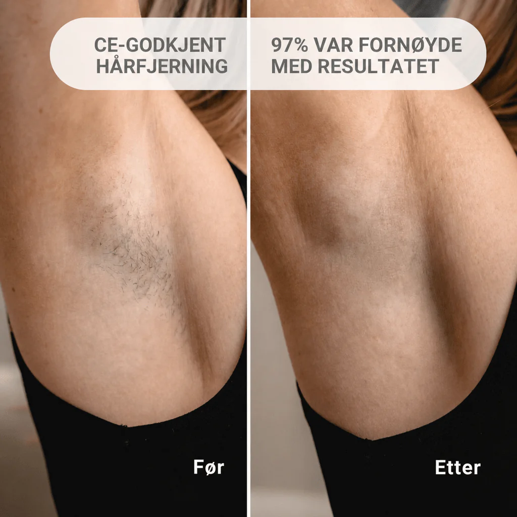 Produktbilde 3