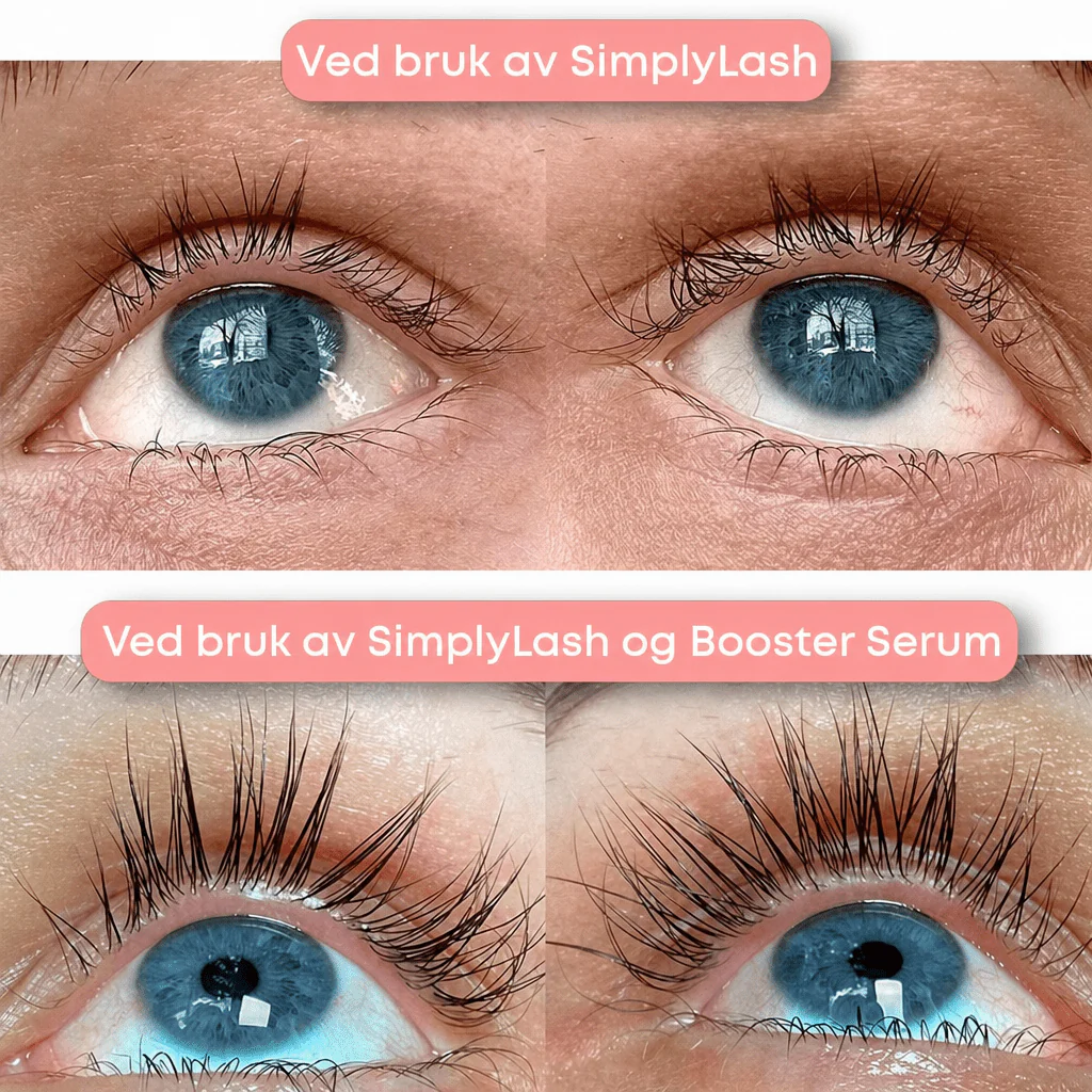Produktbilde 3